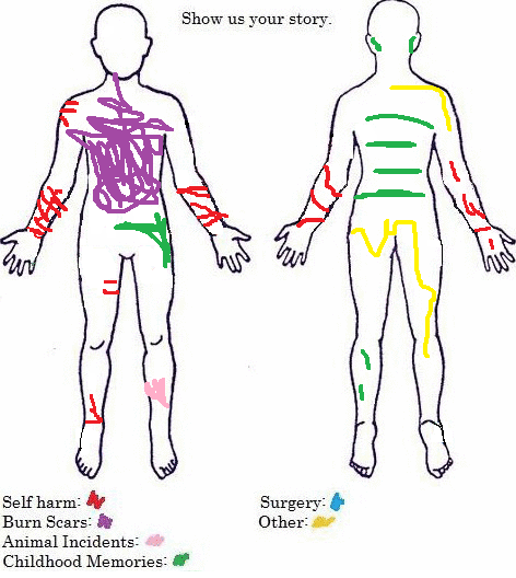 Scar Chart by alphawolfgirl99 on DeviantArt