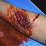 Zombie glue stick bite wound 3