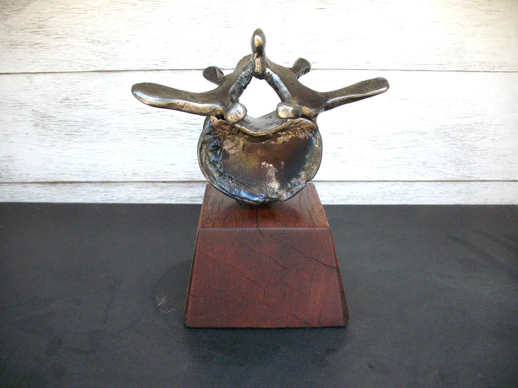 Human Vertebra L3 Prototype