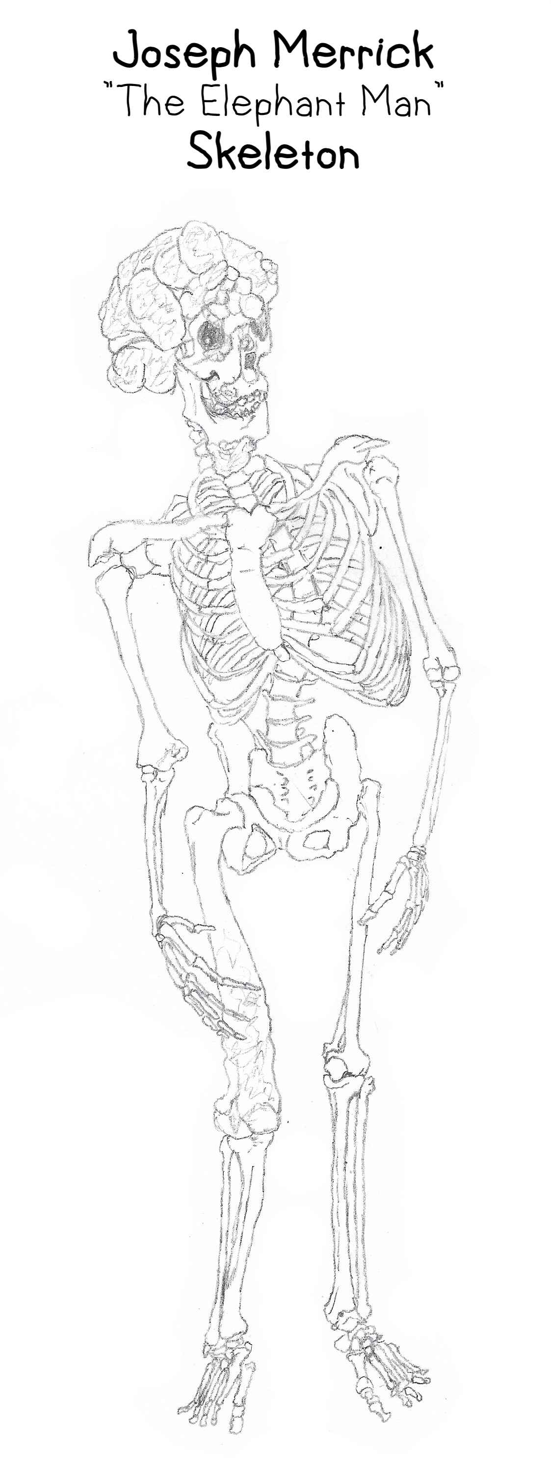 Merrick Skeleton Joseph Merrick Skeleton