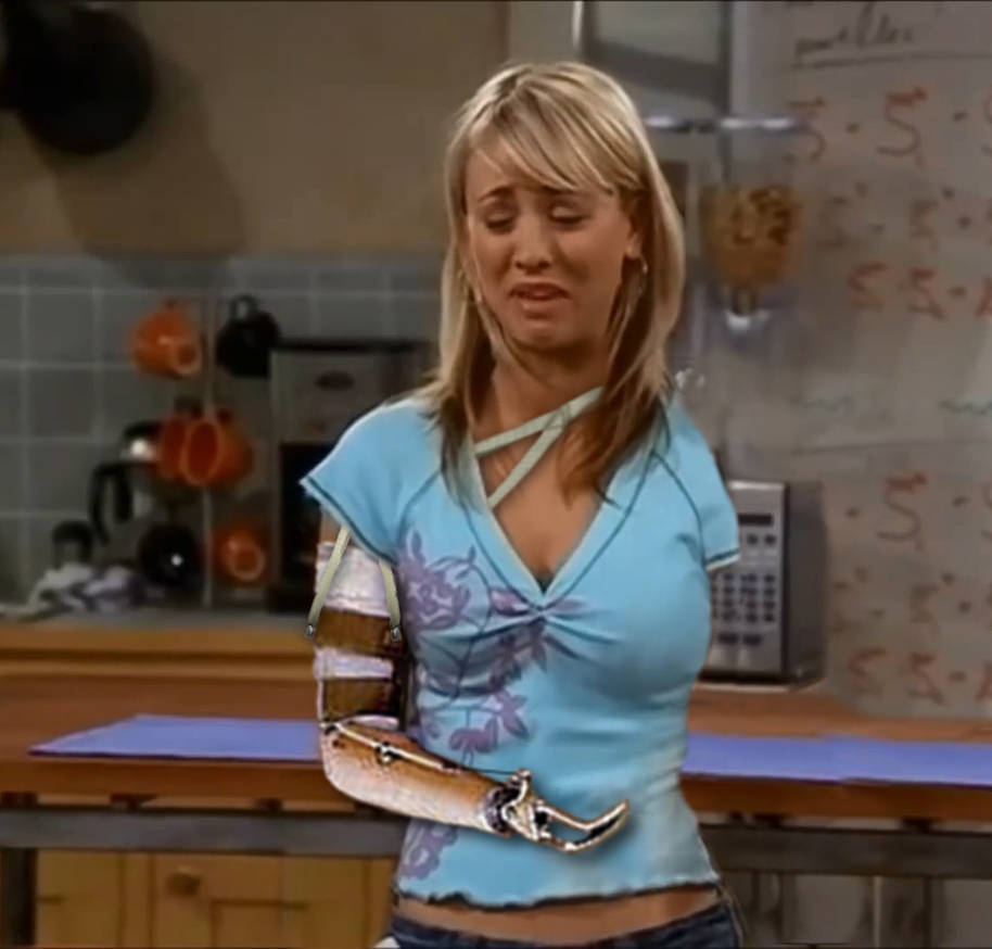 Double arm amputee by Limblessgirl on DeviantArt