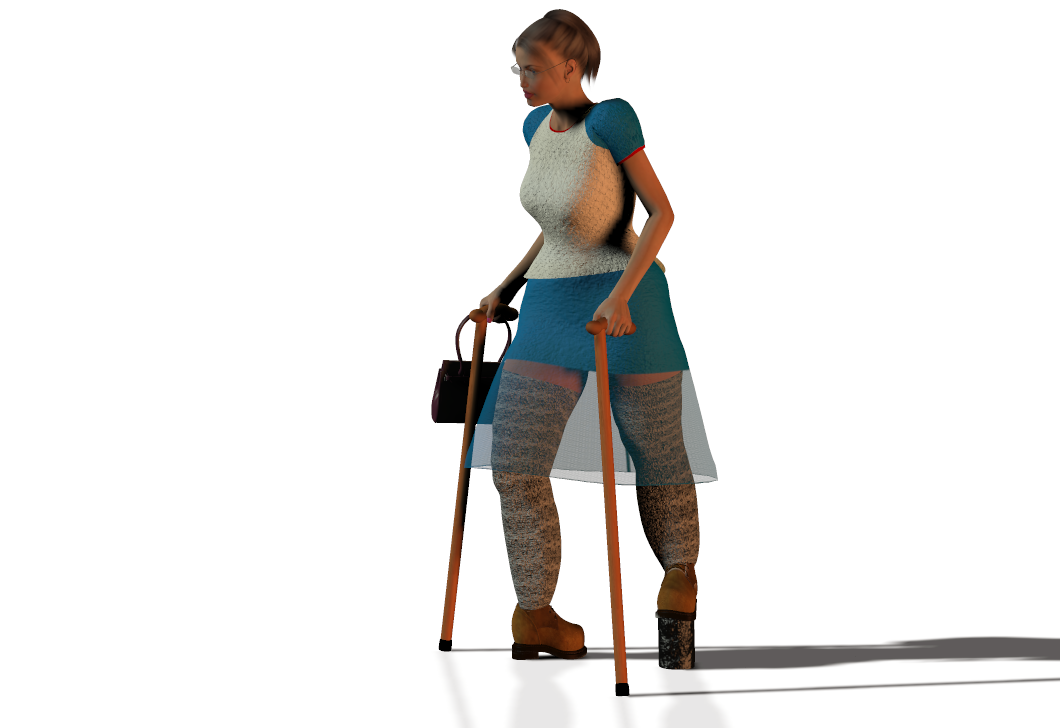 Leg Modification Deviantart Deformed disabled leg girl 3 by Jirinovsky on DeviantArt