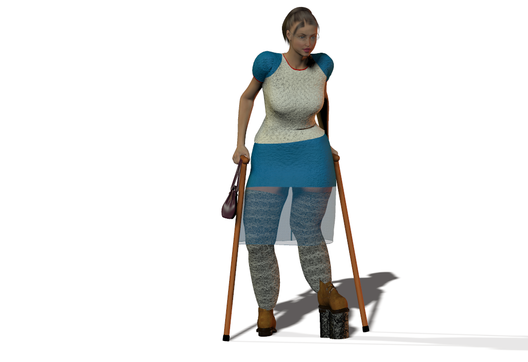 Leg Modification Deviantart Deformed disabled leg girl 5 by Jirinovsky on DeviantArt