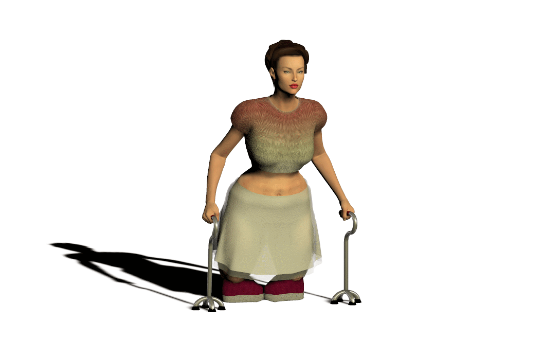 Disability legs by Jirinovsky on DeviantArt