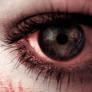 Infected eye