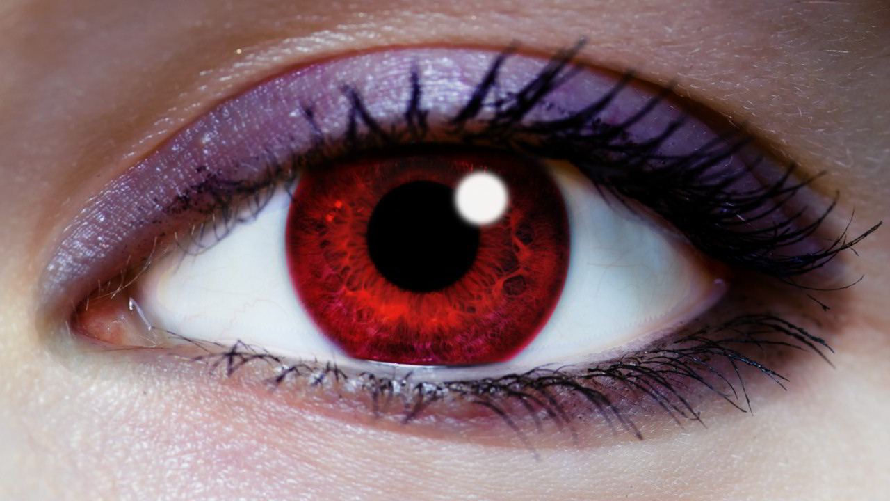 People Born With Red Eyes