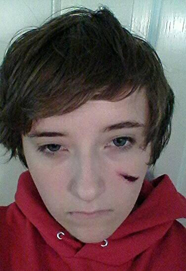 fake scratch by creepynoodle11 on DeviantArt