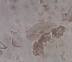 Diatoms 1