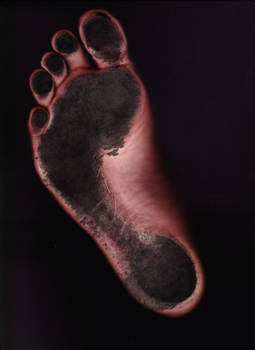 Dirty Foot Scan