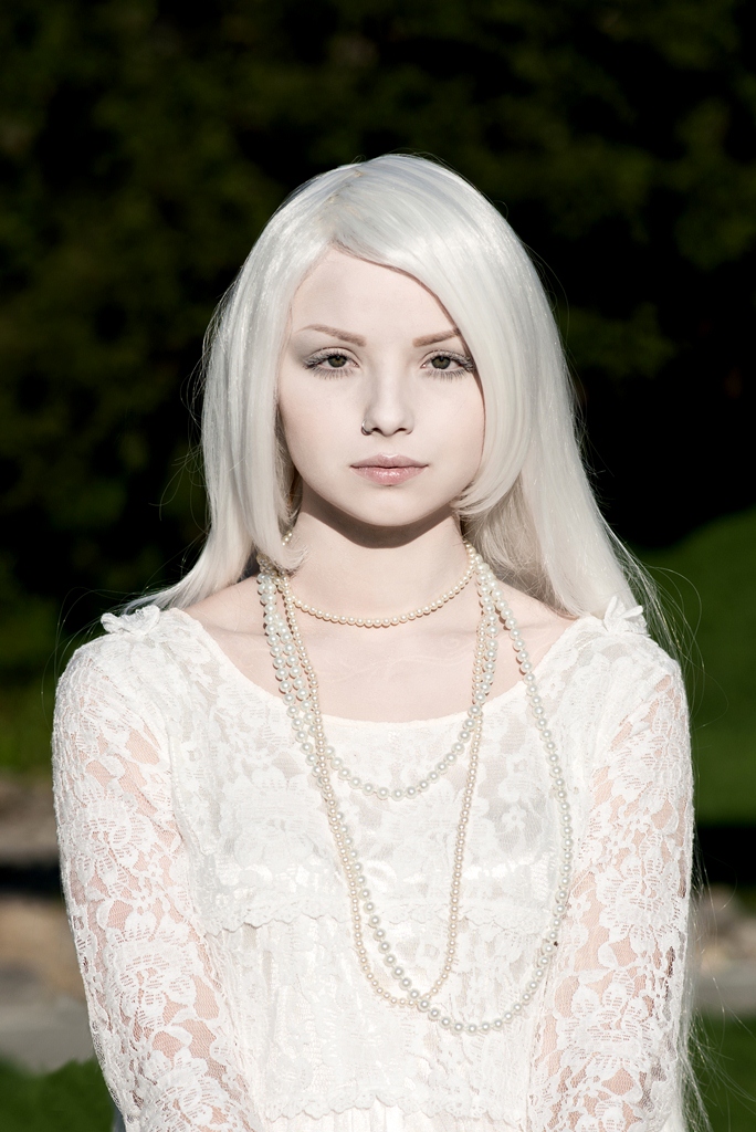 Albino