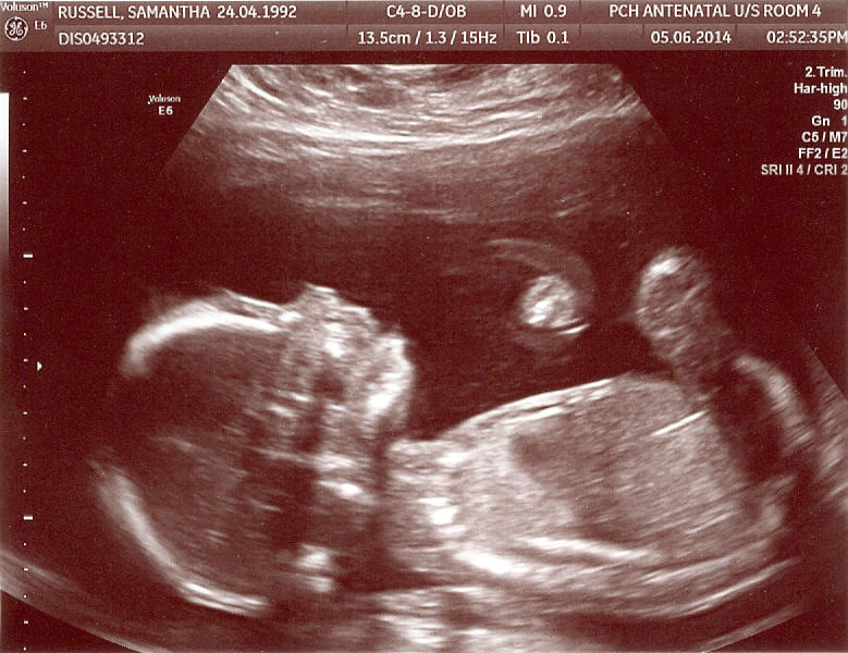 Love My Baby Scan Vf