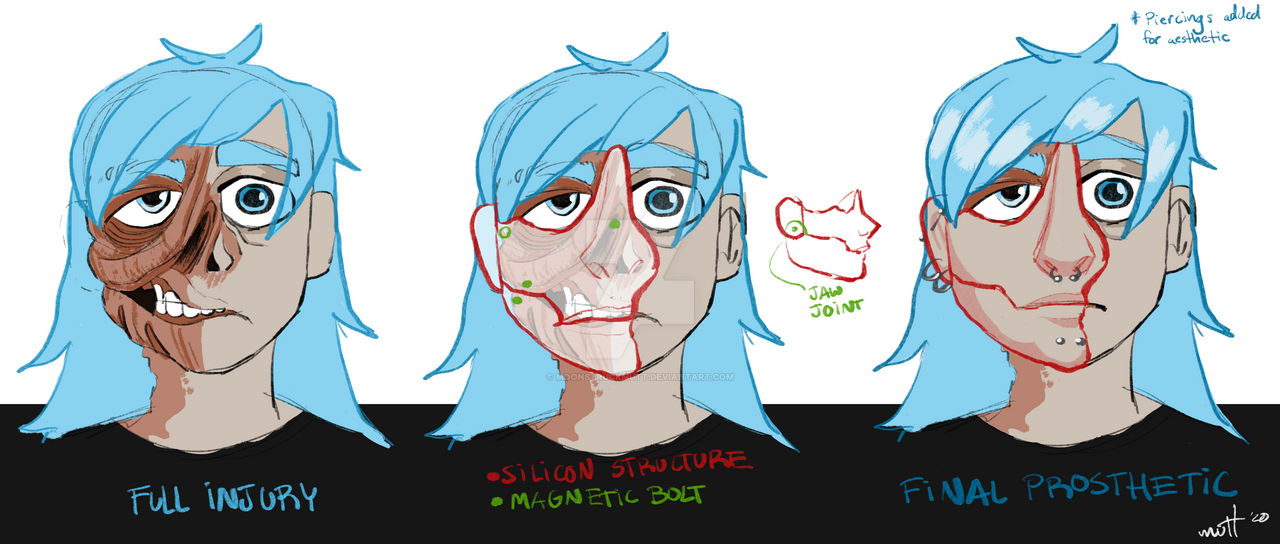 Sally Face New Prosthetic By Moonstruckmutt On DeviantArt sally-face-new-prosthetic-by-moonstruckmutt-on-deviantart