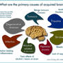 Primary causes of acquired brain injury