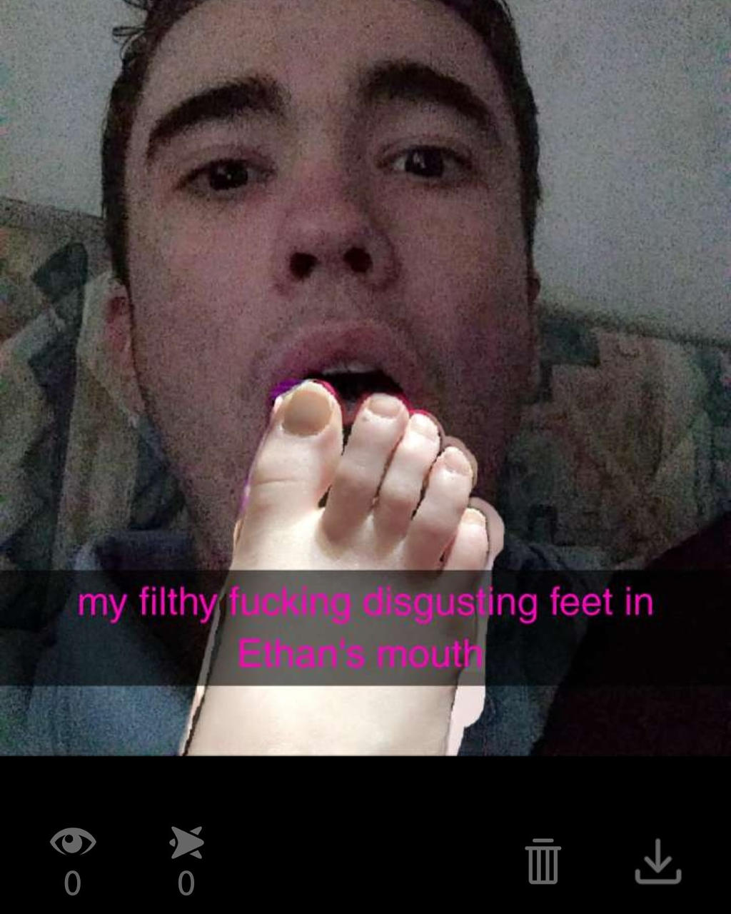 Toes Discusting Disgusting toes by CholetheQueenhah on DeviantArt