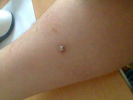 Microdermal