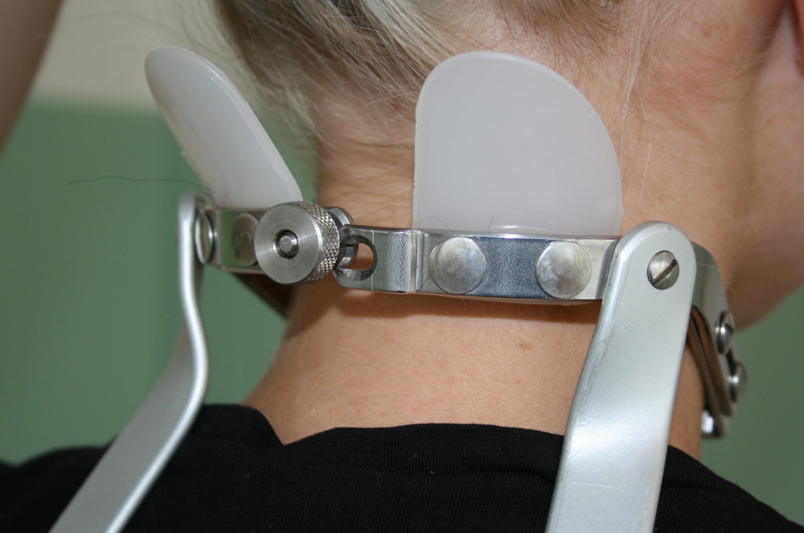Neck Rotation Lock Milwaukee brace - lock on neck ring by DagmarP on DeviantArt