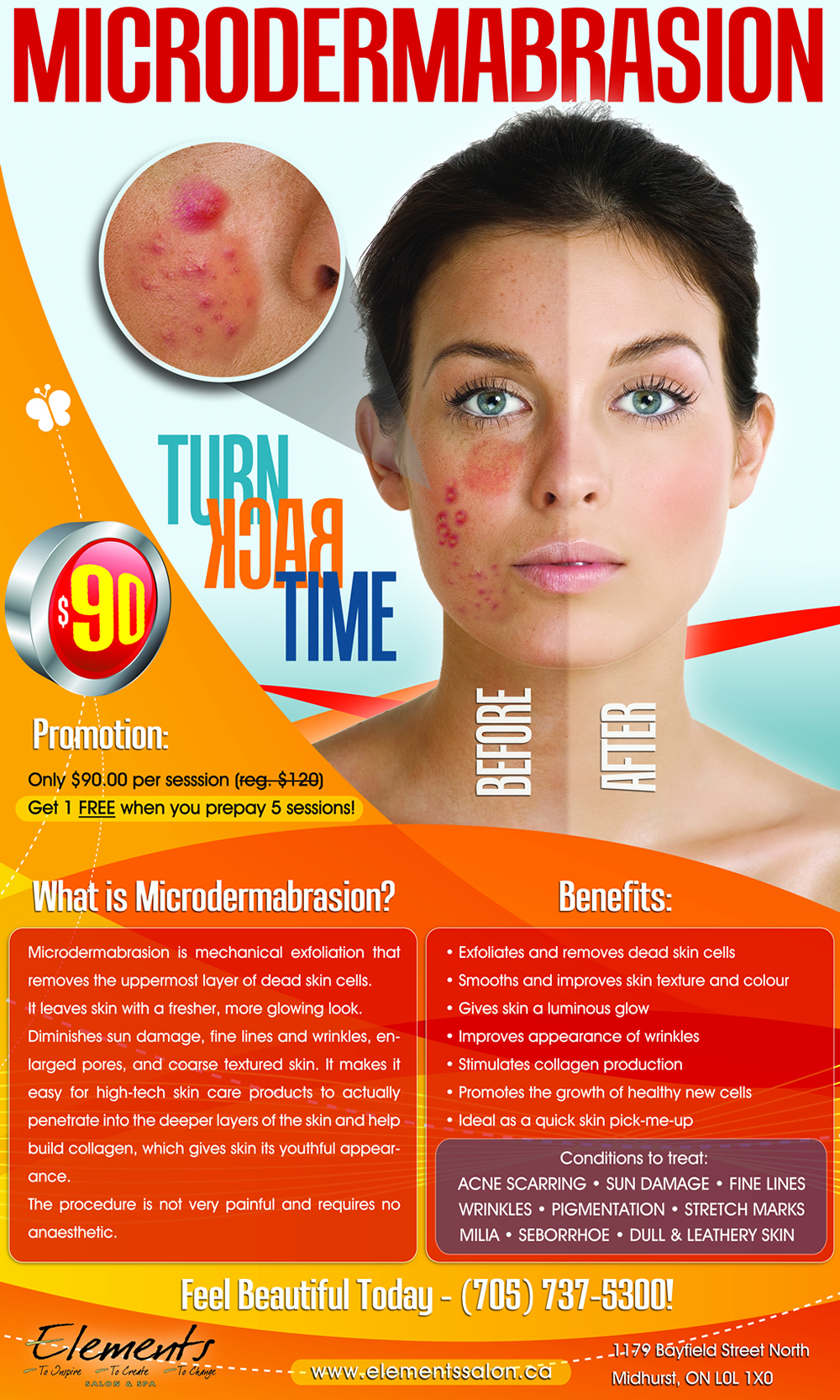 Microdermabrasion poster