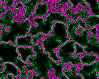 Bacteria Strand - Purple