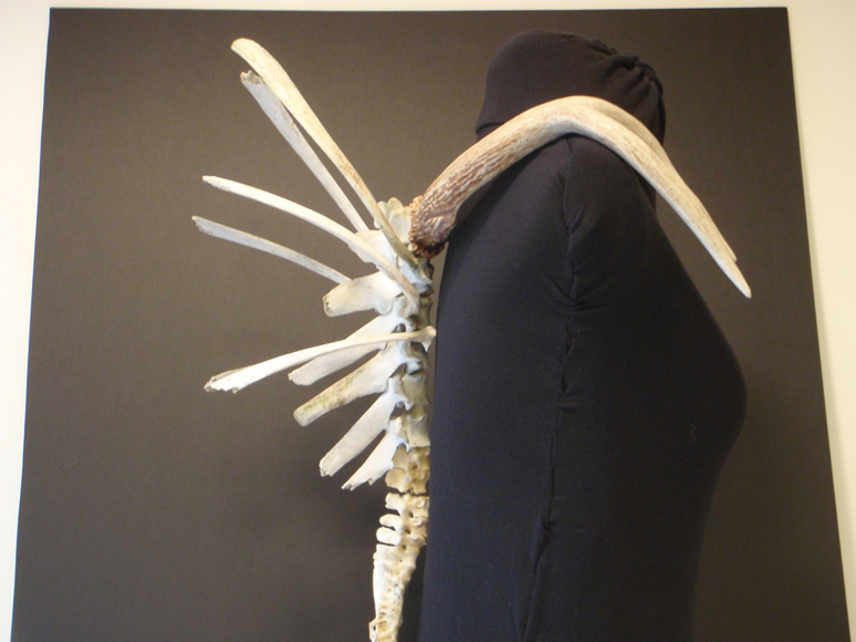 side view of back bone armor