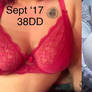Breast Expansion Progress