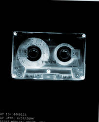 Cassette Xray