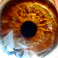 My eye