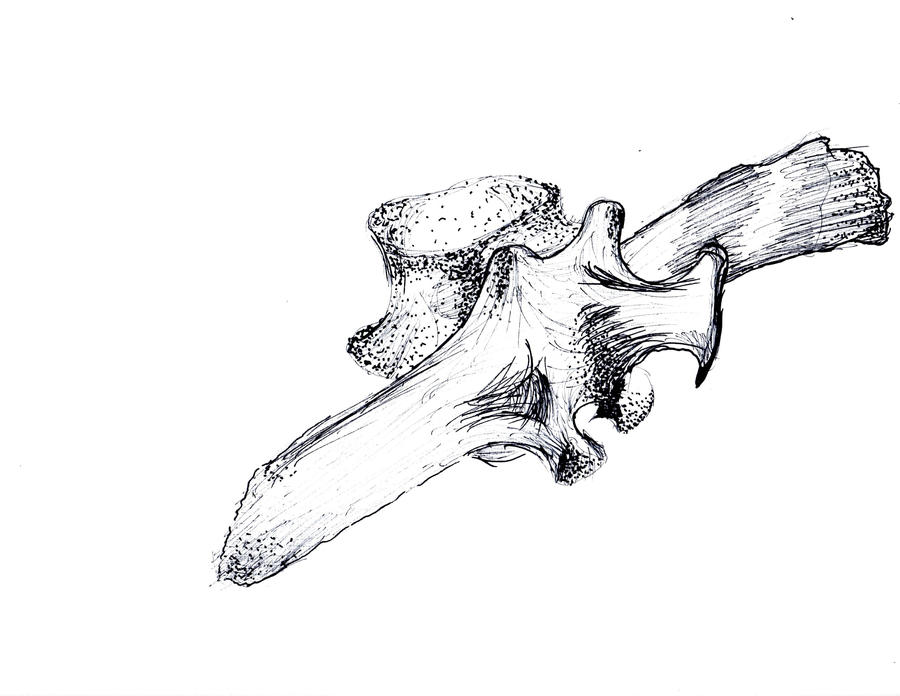 Vertebrae