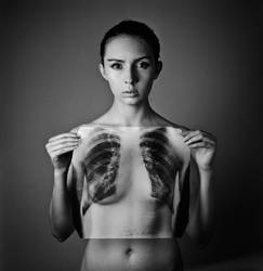 x-ray by psychiatrique