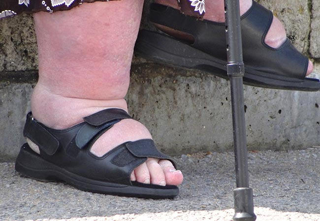 Fat Chubby Feet In Really Tight Sandals by KungFlew2013 on DeviantArt