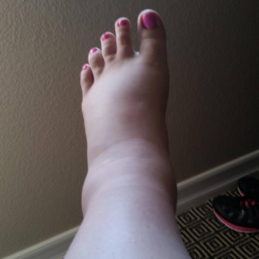 Destiny's Fat Chubby Foot by KungFlew2013 on DeviantArt