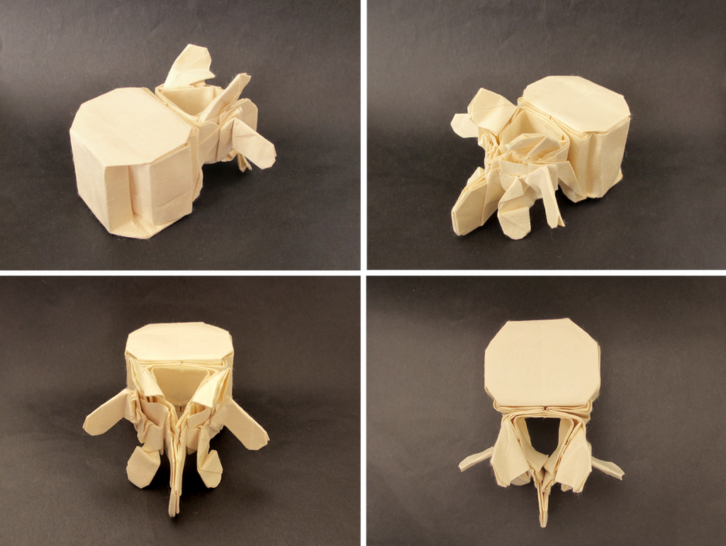 Lumbar Vertebra