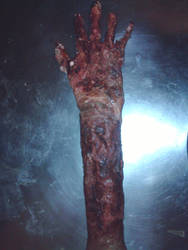 Rotting Arm 5