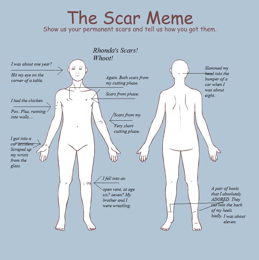 Scar Meme