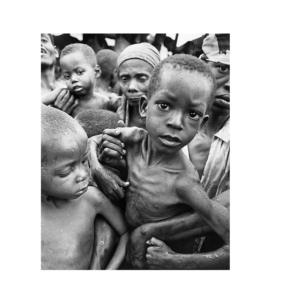 Poverty in Africa