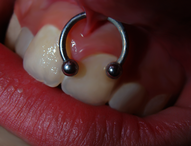 Jaymz Smiley Piercing by omglisaa on DeviantArt