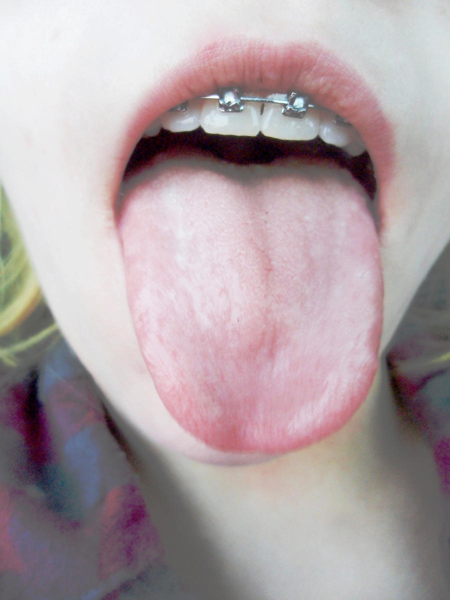 tongue-shots