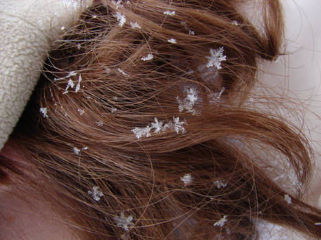 Snowflakes in Hair