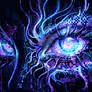 Migraine