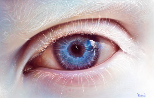 albino eye