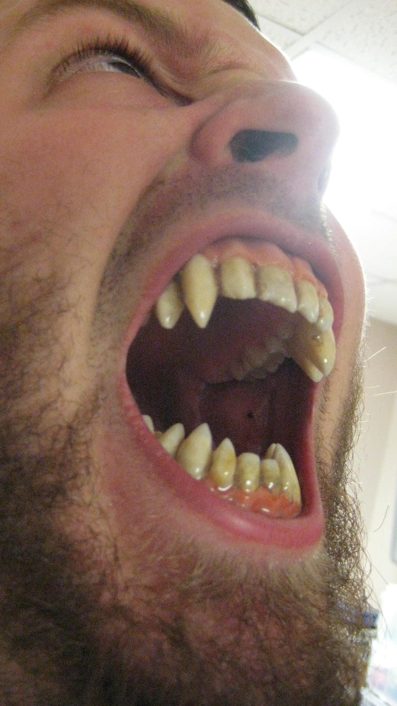 Sharp Tooth Sharp teeth by UnboundArt on DeviantArt