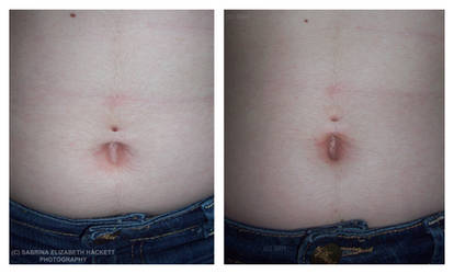 Belly Piercing - No Bar