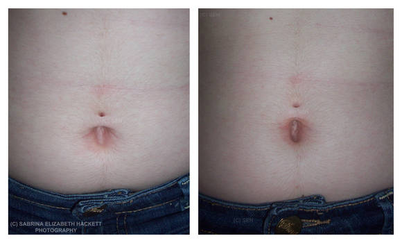 Belly Piercing - No Bar