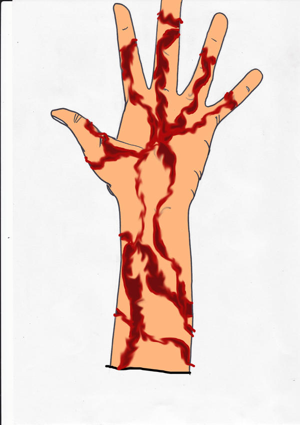 ash's scar mark 4 by AcA-cat on DeviantArt