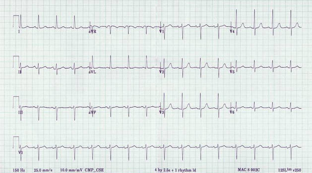 Stock Image - EKG Page