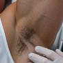 Marine and the ticklish itch