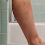 Stuck to Ashley after her shower