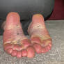 Dirty wrinkly soles