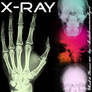 X-RAY