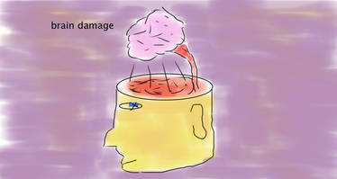 brain damage