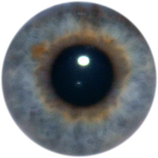 Eye